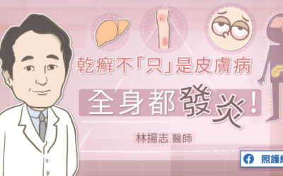 乾癬不「只」是皮膚病，全身都發炎！