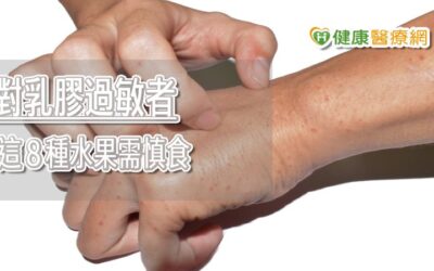 戴乳膠手套手紅腫又發癢？　敏感體質這８種水果盡量別碰