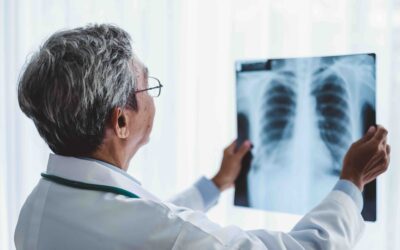 哪些人應每年接受肺癌篩檢？