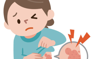 帶狀皰疹會復發嗎？年齡越大越容易得?